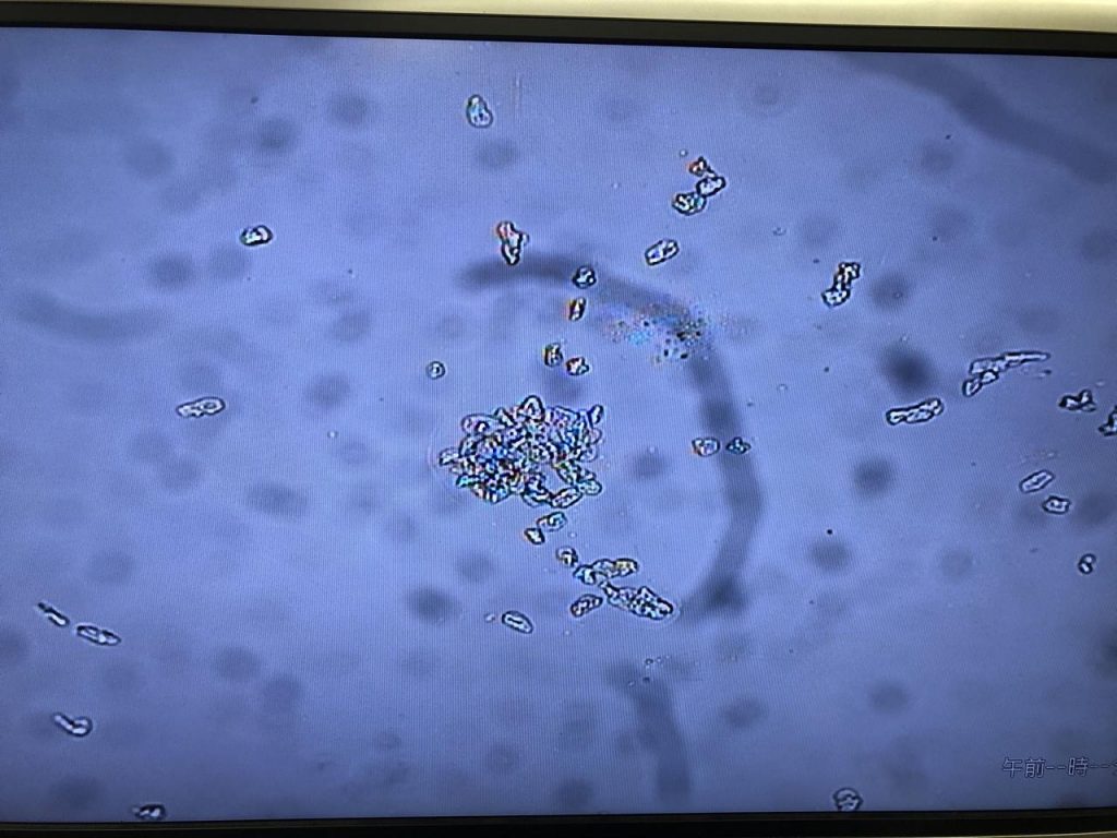 肉眼では見えない世界 閲覧注意 筑波大学附属桐が丘特別支援学校